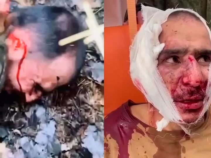Russian security services cut off Crocus City Hall terrorism suspect's ear  during interrogation and make him eat it's ear  during interrogation and make him eat it