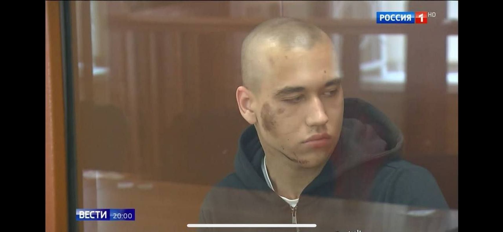 В сюжете «Вестей» показали 18-летнего Михаила Балашова, задержанного по делу о попытке покушения на Симоньян и Собчак. На его лице и шее были отчетливо видны ссадины и синяки